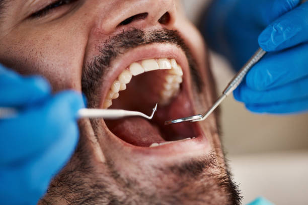 Best Urgent Dental Care for Toothache in Glenpool, OK