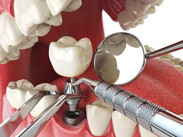 Best Emergency Dentist for Knocked-Out Tooth in Glenpool, OK